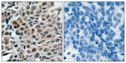 FOXO3, p Ser253 Antibody, Novus Biologicals 0.025 mL; Unconjugated:Antibodies,